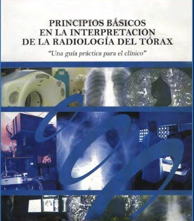 Principios Básicos en la interpretación de la Radiología del Tórax