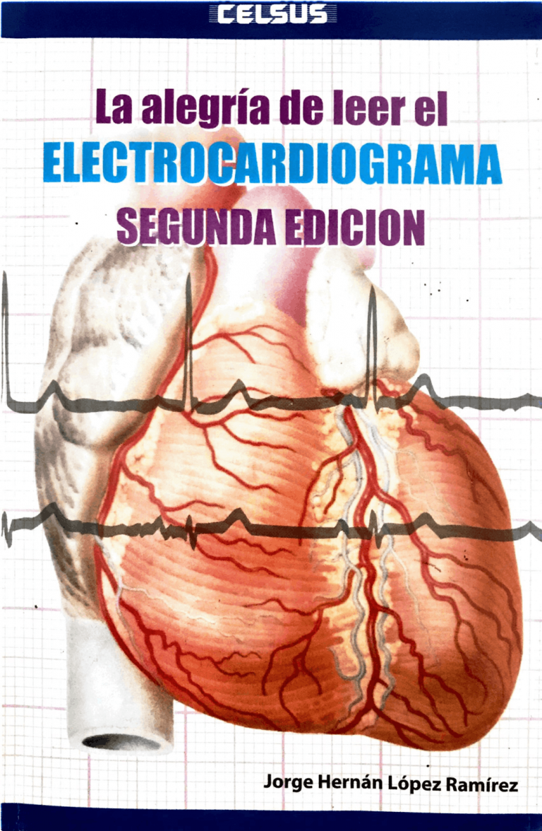 ELECTROCARDIOGRAMA NORMAL