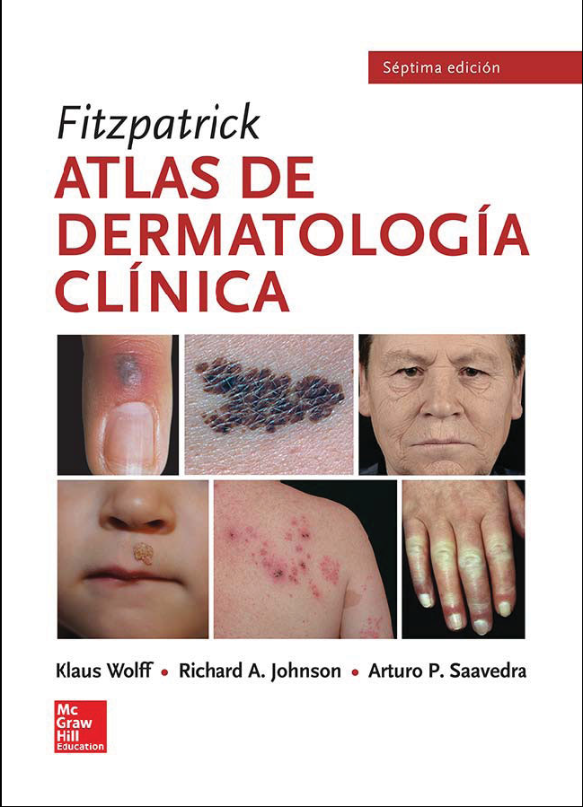 ATLAS DE DERMATOLOGÍA CLINICA