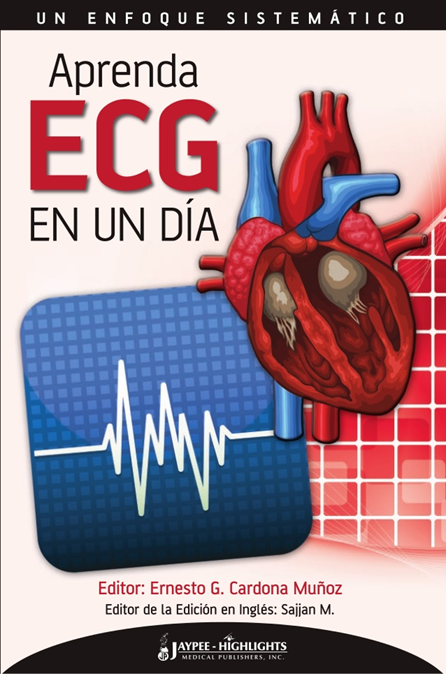 APRENDE ECG EN UN DÍA
