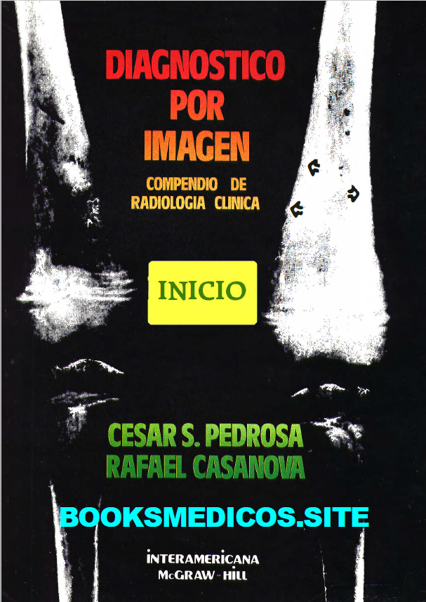 Diagnostico por imagen: Radiología de Pedrosa