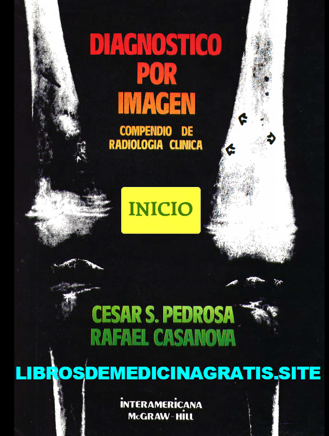 Diagnostico por imagen: Radiología de Pedrosa 