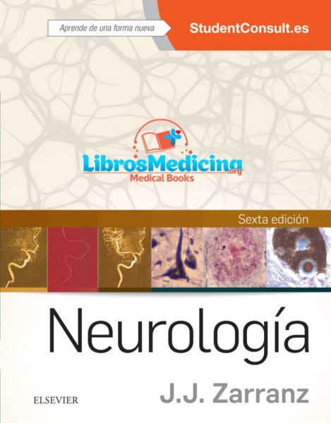 Neurologia (Juan J. Zarranz)