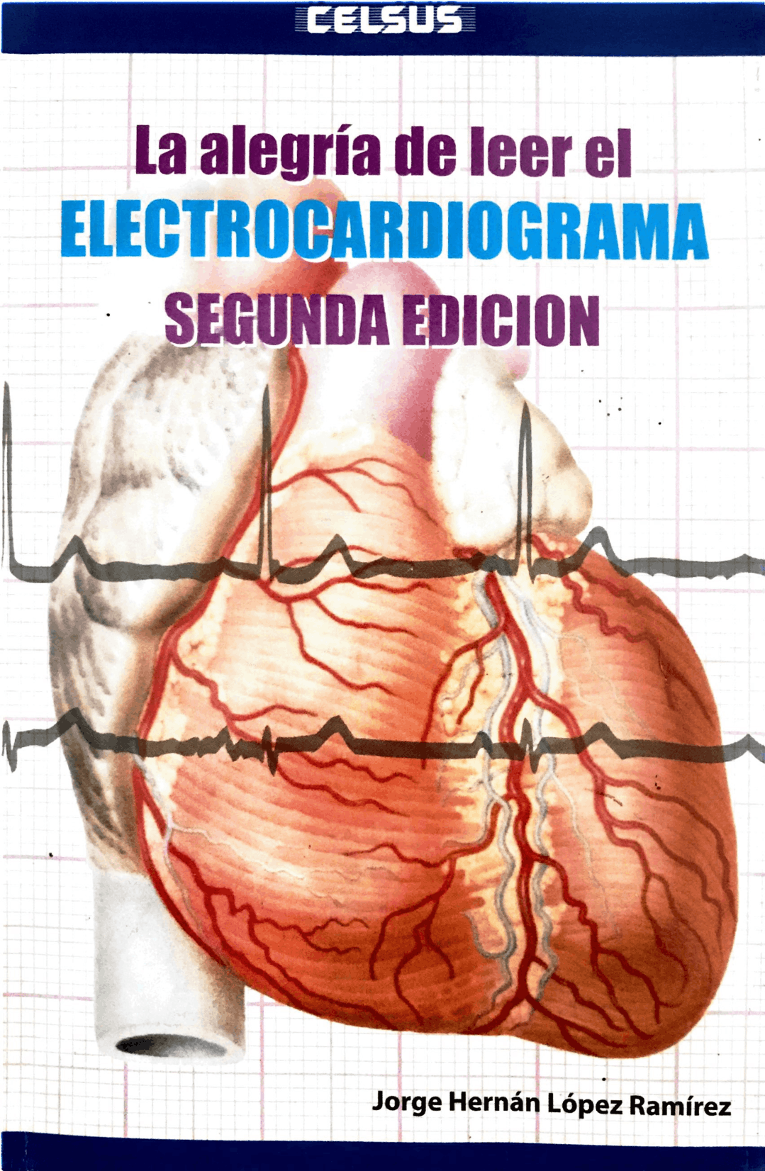 ELECTROCARDIOGRAMA NORMAL