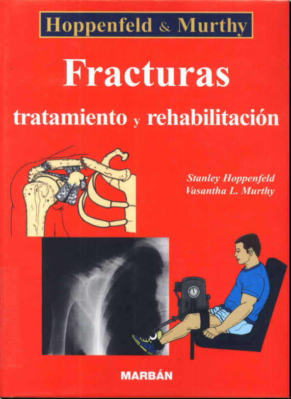 Fracturas tratamiento y rehabilitación (Hoppenfeld)