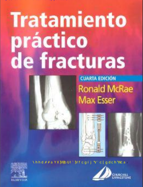 Tratamiento practico de fracturas (McRae)