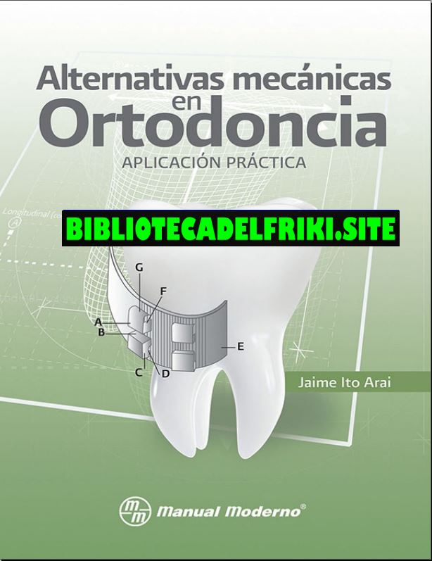 Alternativas mecánicas en ortodoncia (Ito)