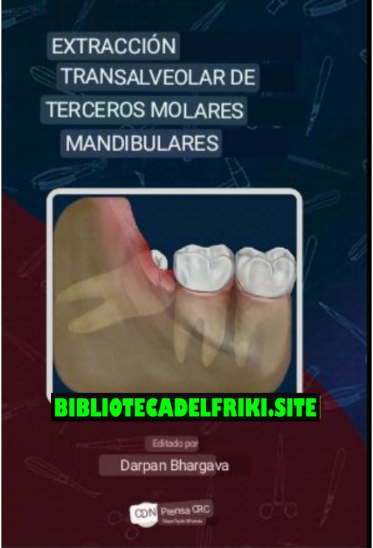 Extracción transalveolar de terceros molares mandibulares