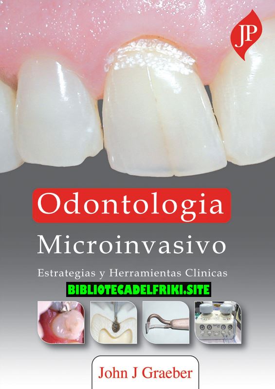 Odontología microinvasiva (John Graeber)